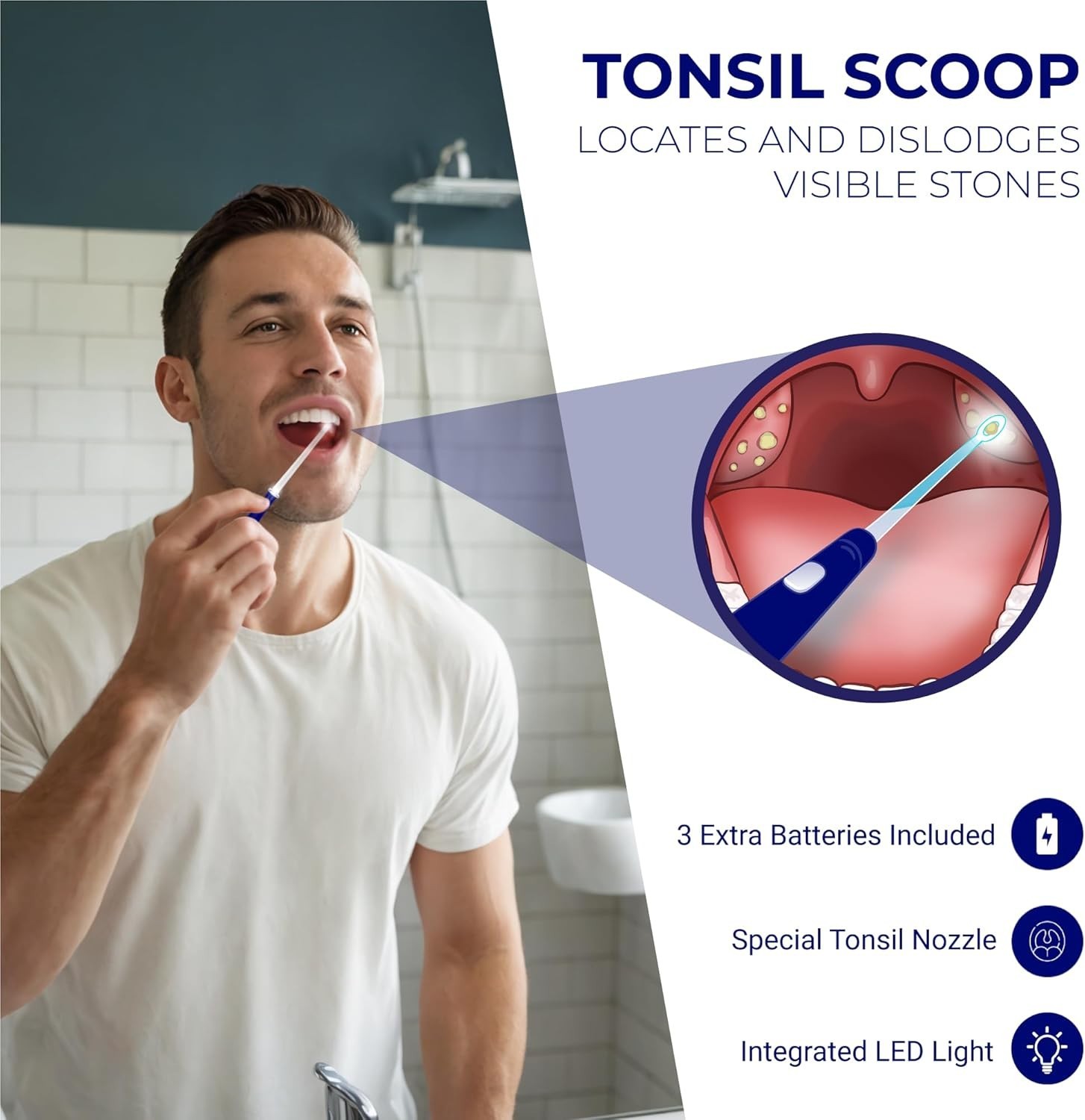 Tonsil Stone Vacuum, Tonsil Stone Remover Vacuum Suction, Tonsil Stone Cuppin…